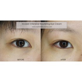 Intensive Nourishing Eye Cream (10gr)