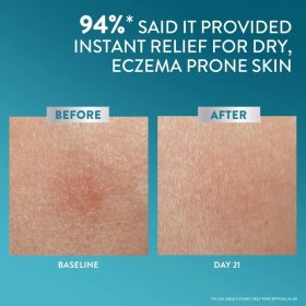 Pro AD Derma Repair Cream (227gr)